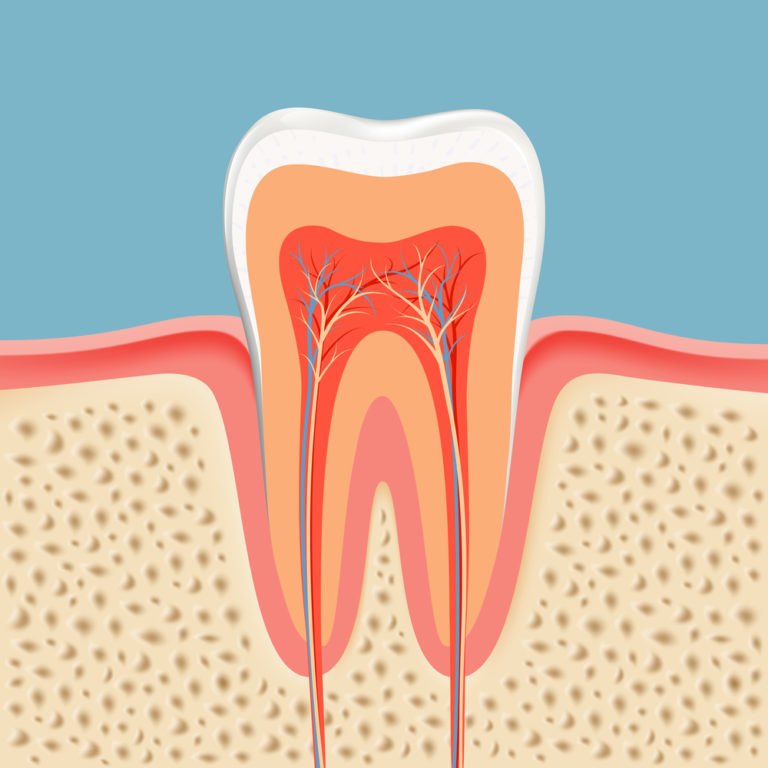 root canals (treatment)